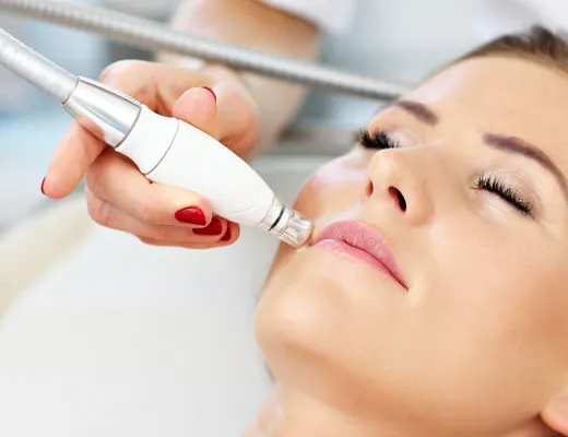 Épilation rapide et efficace de la lèvre supérieure